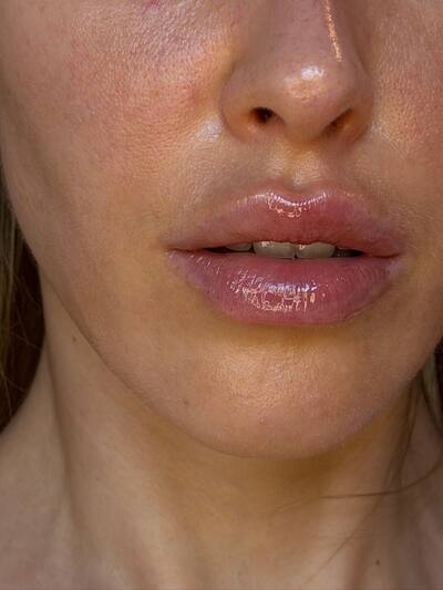 Detalle de los labios y la piel de Kristina